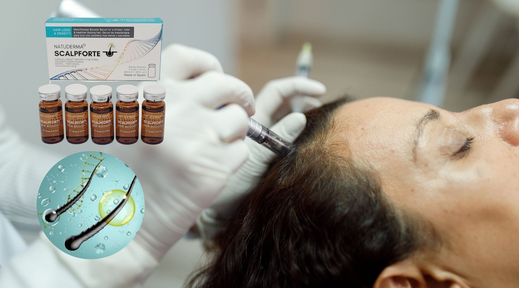 How Exosomes & Capilia Longa Are Redefining Hair Growth Treatments   Dermishop