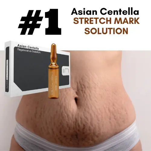 ASIAN CENTELLA, Stretch Mark Solution.
