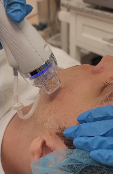 Facial Equipment Microdermabrasion Machine Esthetics Machines
