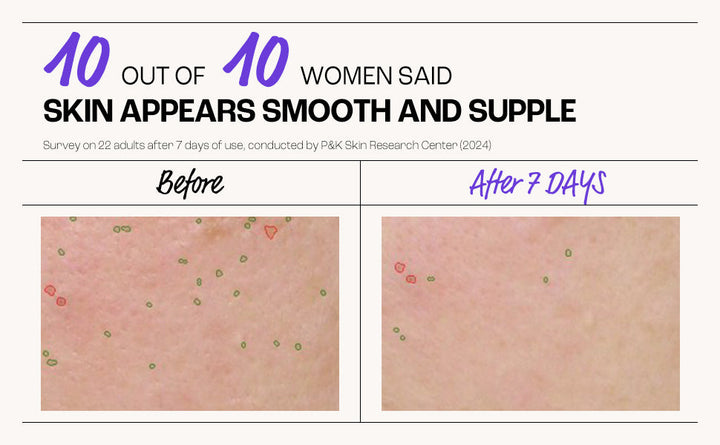 Before and after comparison of skin texture with text indicating survey results.