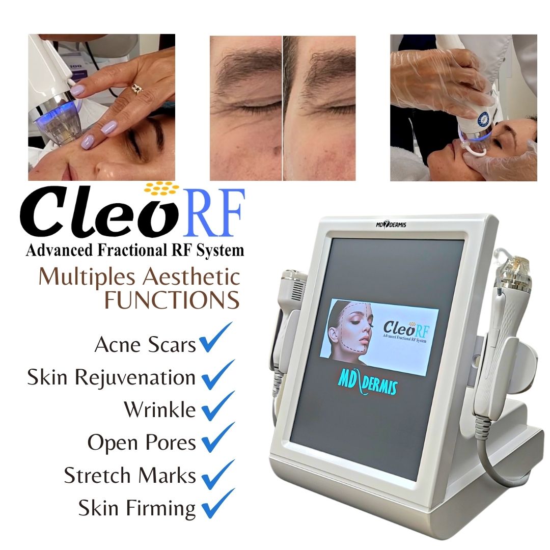 RF Microneedling Machine. Cleo Fractional Radio Frequency RF Microneedling Machine. Cleo Fractional Radio Frequency