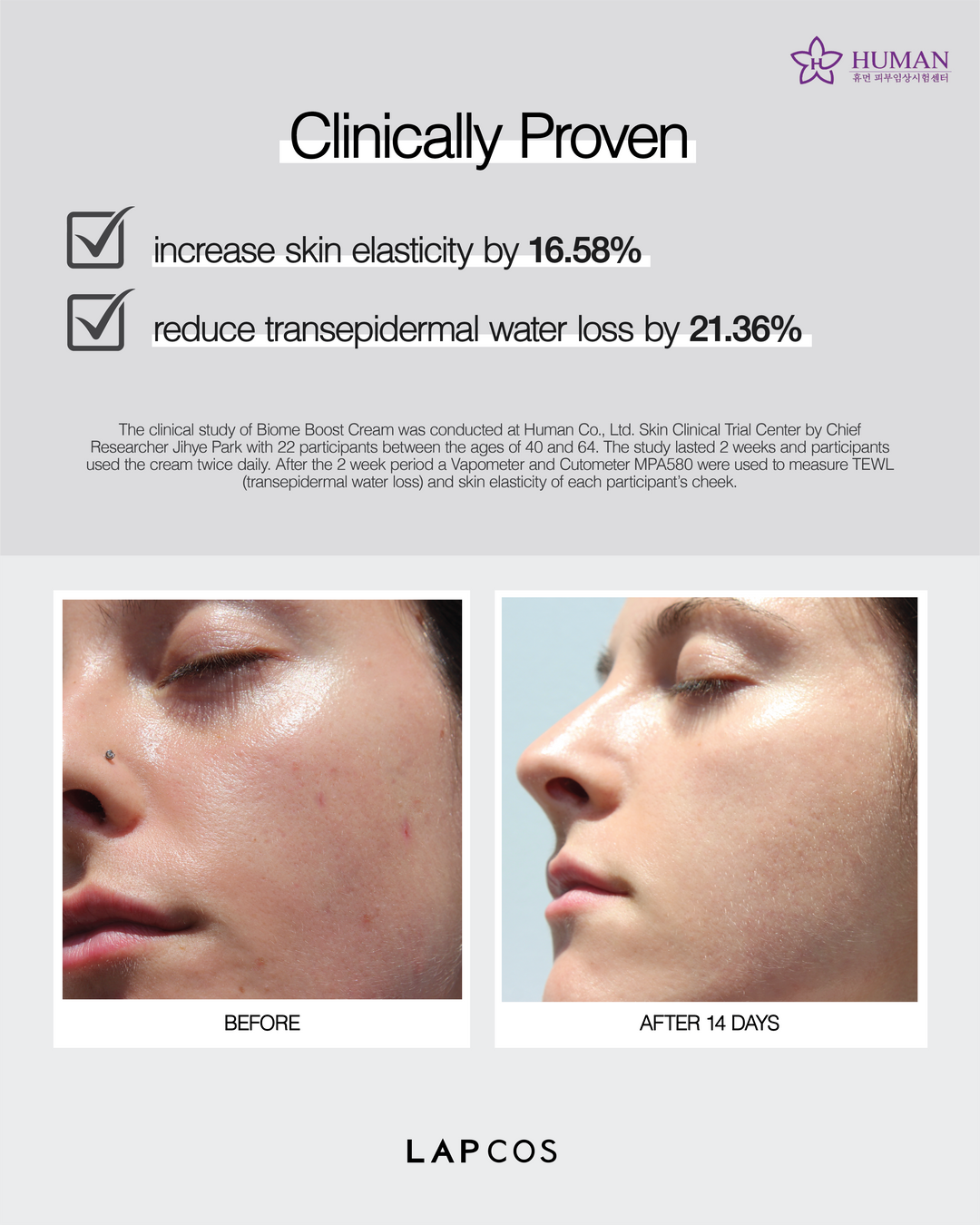 Advertisement for LAPCOS skincare product showing before and after effects on skin.