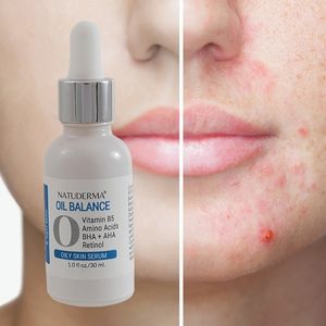 Acne treatment - Pore minimizer - Retinol Serum for Face - Natuderma Oil Balance