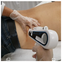 Mesotherapy Gun Mesogun for Serum Infusion, Micro Channeling.