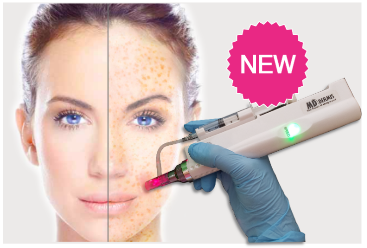 MD Needle Pen - Microneedling Pen and supplies